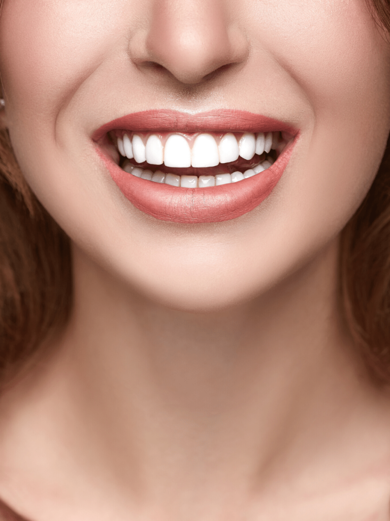 How Much Does Teeth Whitening Cost?