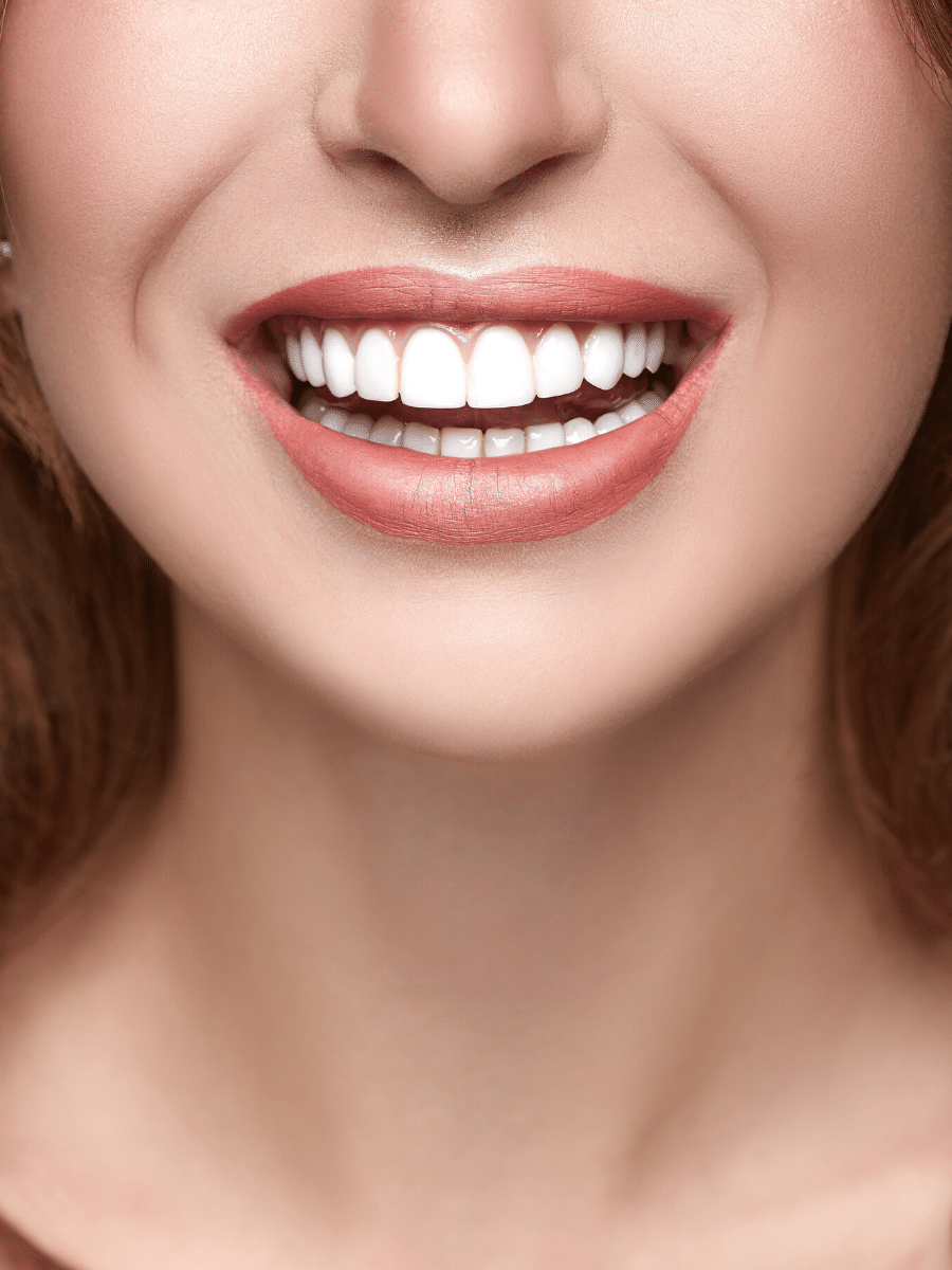 Teeth Whitening Las Vegas