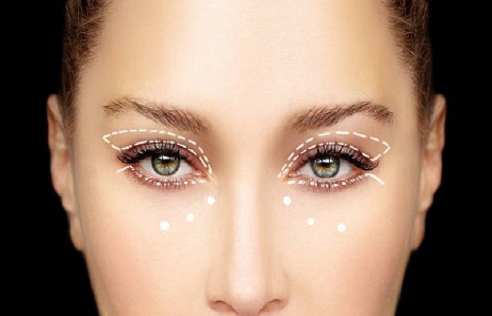 Blepharoplasty Las Vegas