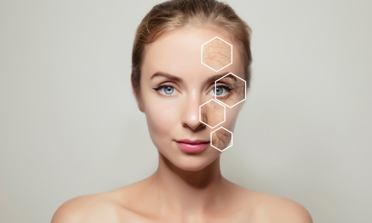 Am I a Candidate for Microneedling?