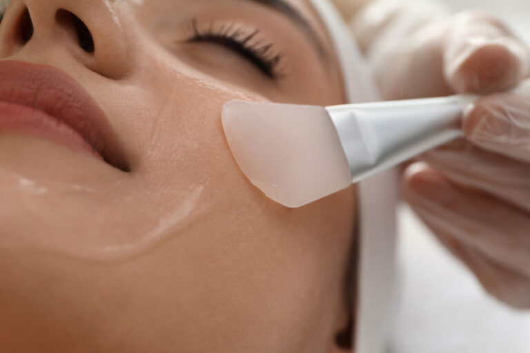 Can Chemical Peels Get Rid of Fine Lines?
