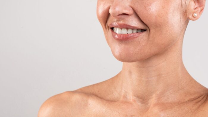 The Basics of a Neck Lift