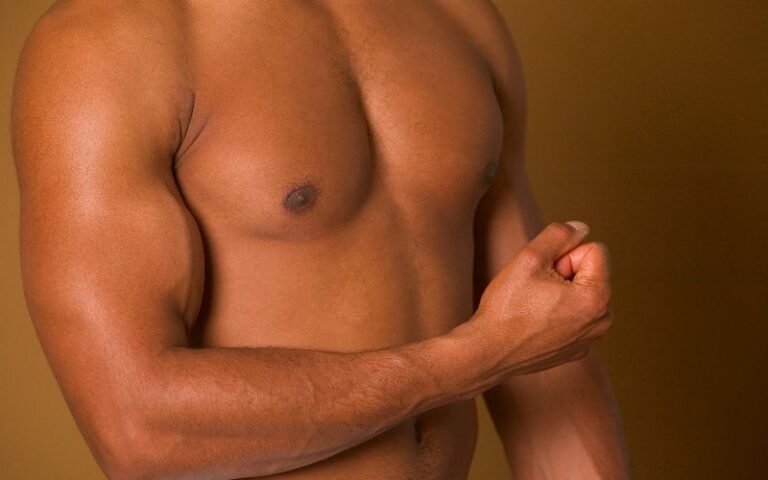 What Causes Gynecomastia?