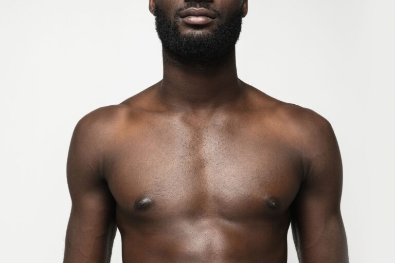 What to Expect After Male Breast Reduction?